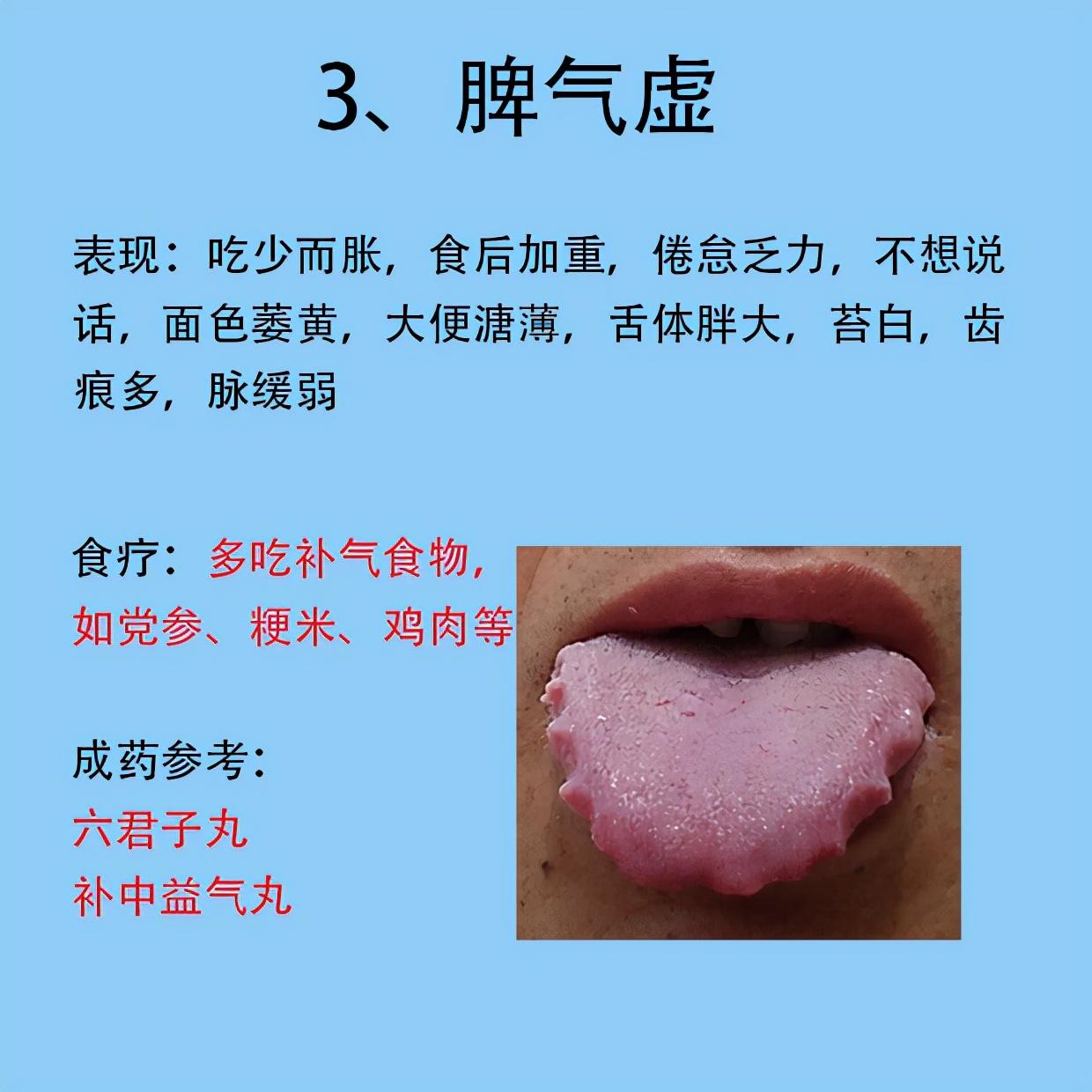 关于五个月宝宝的脾胃虚症状研究